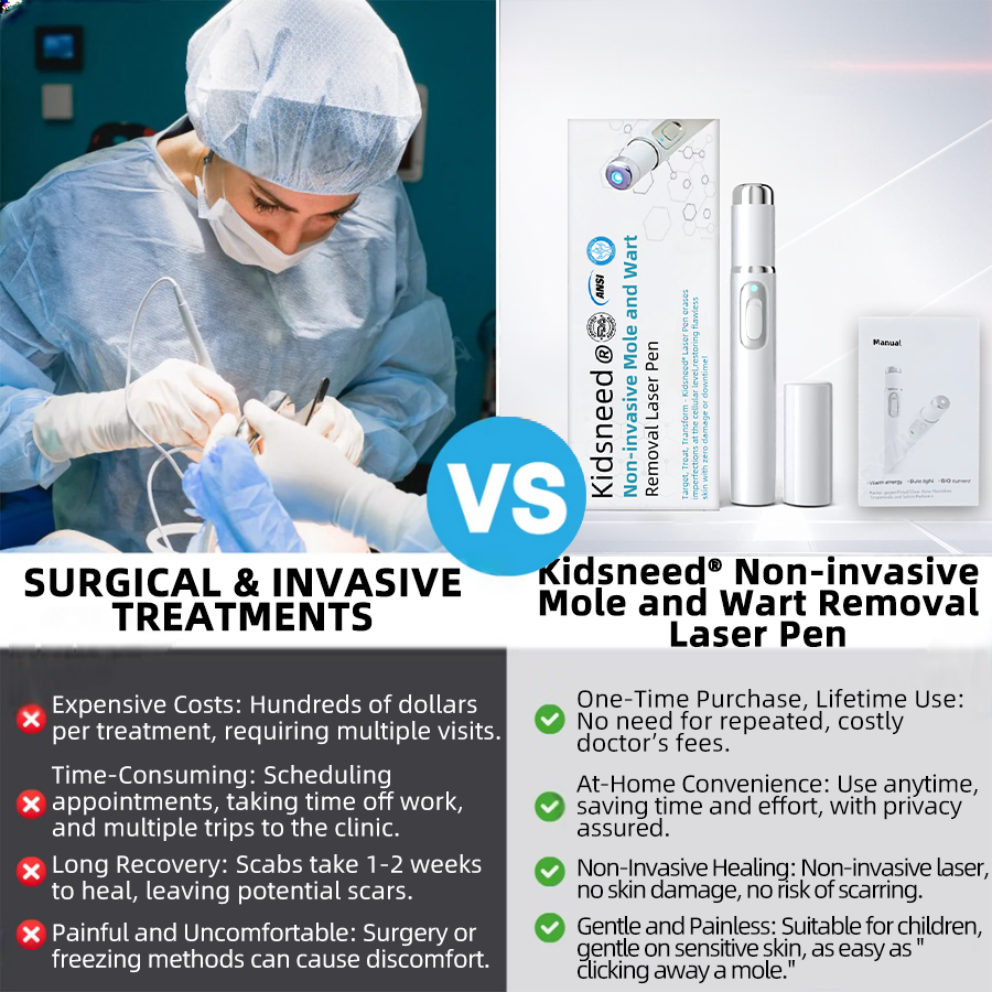 Clinically Reviewed by Mayo Clinic Experts: 👩⚕️𝑲i𝒅sn𝒆𝒆𝒅® 𝑵on-i𝒏va𝒔𝒊ve 𝑴o𝒍e an𝒅 𝑾ar𝒕 𝑹emo𝒗𝒂𝒍 𝑳ase𝒓 𝑷en 𝑷roma𝒙 (Fast and painless removal of warts, moles, age spots, and skin tags — completely without side effects.)✈️