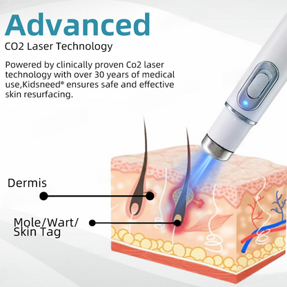 Clinically Reviewed by Mayo Clinic Experts: 👩‍⚕️𝑲i𝒅sn𝒆𝒆𝒅® 𝑵on-i𝒏va𝒔𝒊ve 𝑴o𝒍e an𝒅 𝑾ar𝒕 𝑹emo𝒗𝒂𝒍 𝑳ase𝒓 𝑷en 𝑷roma𝒙 （Fast and painless removal of warts, moles, age spots, and skin tags — completely without side effects.）✈️