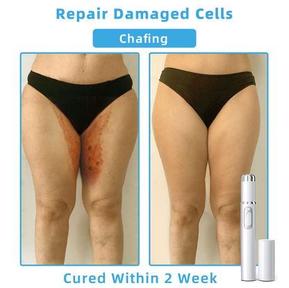 Clinically Reviewed by Mayo Clinic Experts: 👩‍⚕️𝑲i𝒅sn𝒆𝒆𝒅® 𝑵on-i𝒏va𝒔𝒊ve 𝑴o𝒍e an𝒅 𝑾ar𝒕 𝑹emo𝒗𝒂𝒍 𝑳ase𝒓 𝑷en 𝑷roma𝒙 （Fast and painless removal of warts, moles, age spots, and skin tags — completely without side effects.）✈️